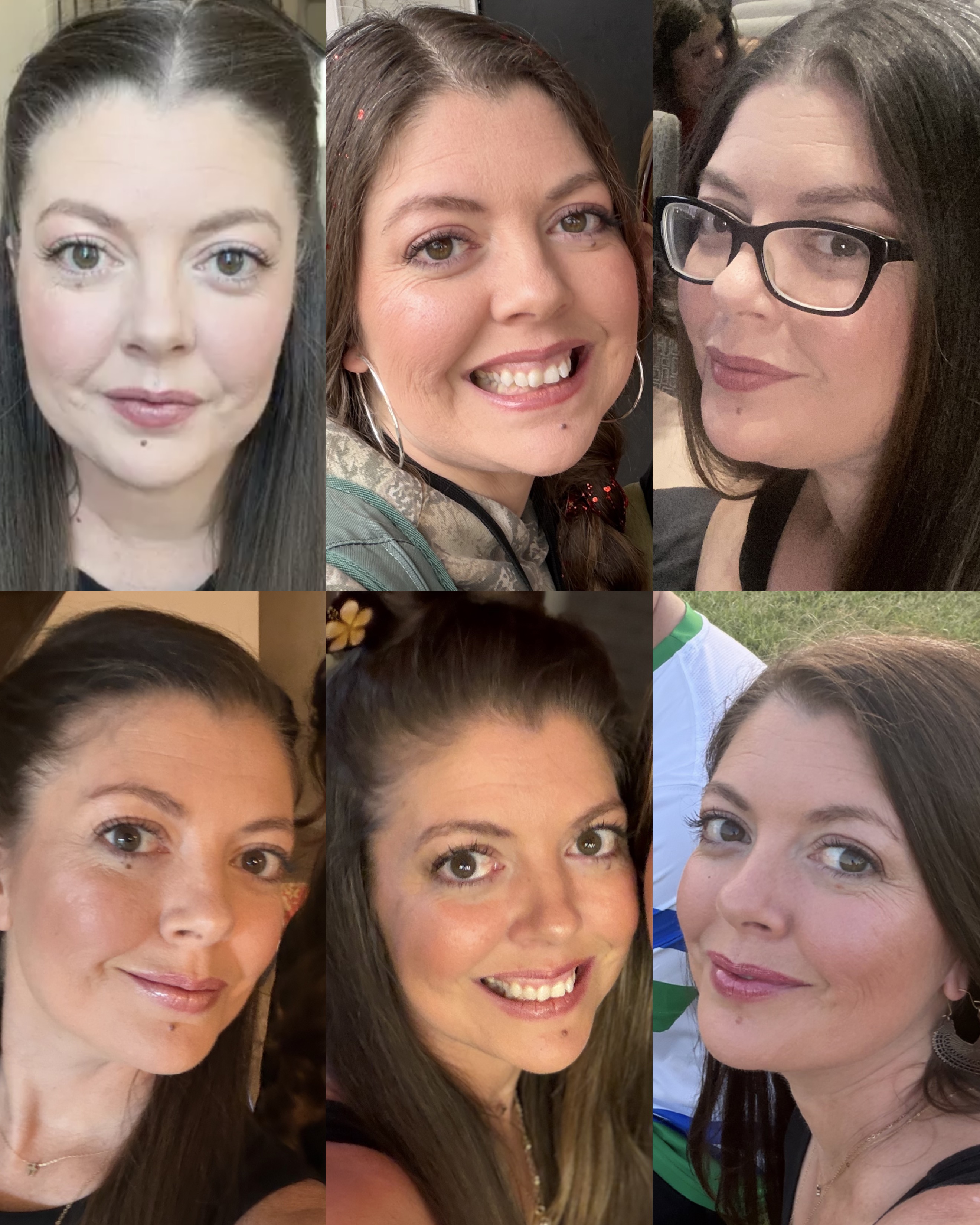Grid of Melissa's face before and after, showing reduced facial puffiness